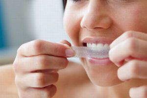 Hướng dẫn sử dụng dải làm trắng răng