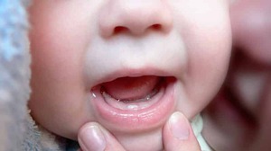 Sự xuất hiện của răng đầu tiên có thể đi kèm với các triệu chứng khác nhau.