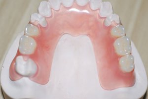 Chân giả nylon đẹp - hàm giả thoải mái.