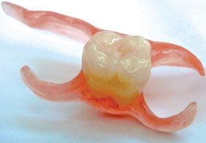 Răng giả tháo lắp - tính năng và vật liệu
