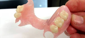 Một hàm răng giả acrylic trông như thế nào?