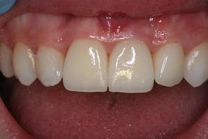 Đặc điểm cấu trúc mô học của răng người