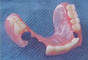 Ưu điểm của hàm giả silicone