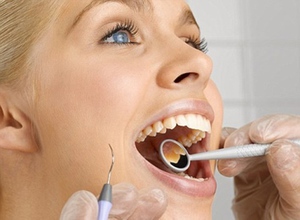 Bao lâu bạn có thể điều trị răng của bạn?