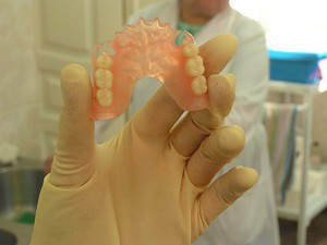 Lắp đặt răng giả nylon