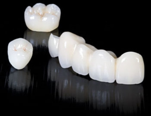 Các loại mão răng