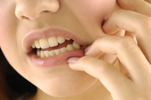 Danh sách các lý do cho sự phát triển không đúng của răng khôn