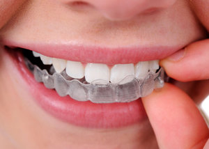 Cách sử dụng hồ sơ
